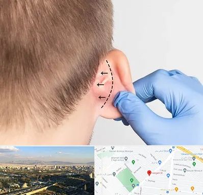 عمل زیبایی گوش در هنگام