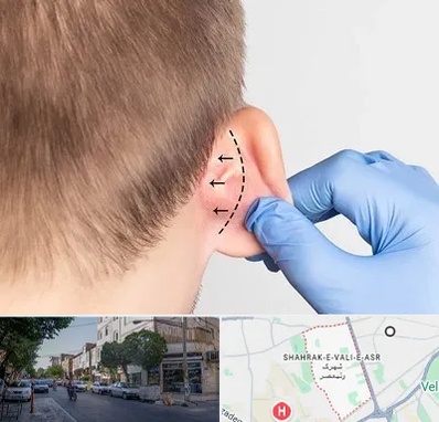 عمل زیبایی گوش در شهرک ولیعصر