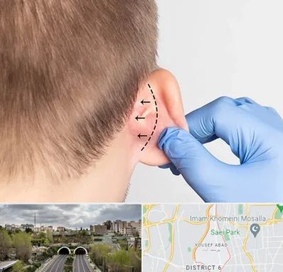 عمل زیبایی گوش در یوسف آباد