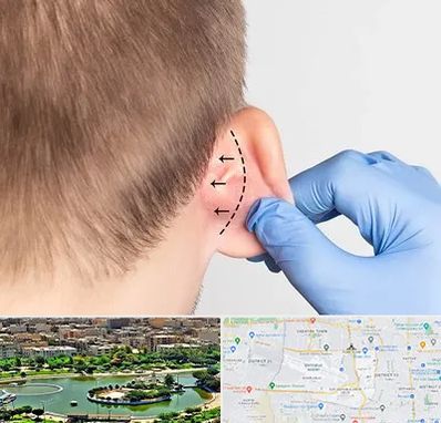 عمل زیبایی گوش در منطقه 9 تهران