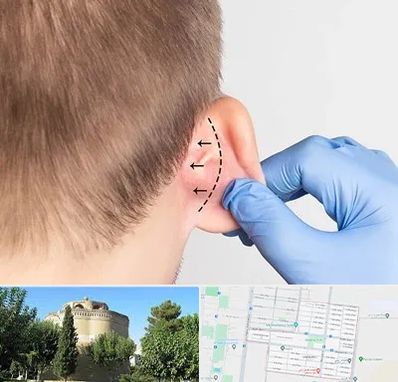 عمل زیبایی گوش در مرداویج اصفهان