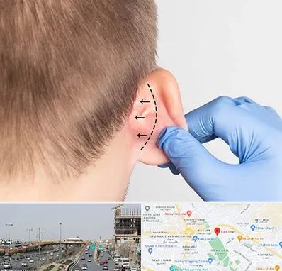 عمل زیبایی گوش در بلوار توس مشهد