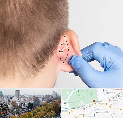 عمل زیبایی گوش در بلوار کشاورز