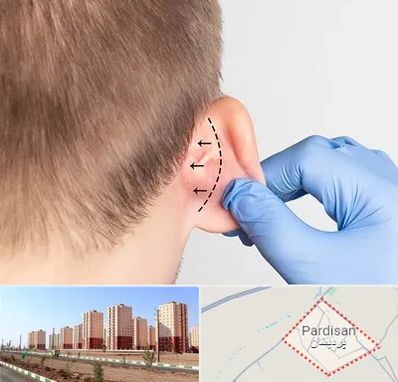 عمل زیبایی گوش در پردیسان قم