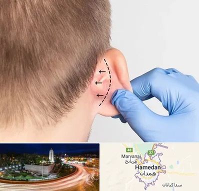 عمل زیبایی گوش در همدان