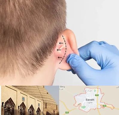 عمل زیبایی گوش در ساوه