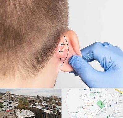 عمل زیبایی گوش در شمیران نو