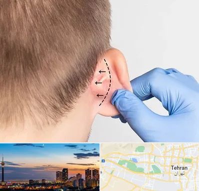 عمل زیبایی گوش در غرب تهران تهران