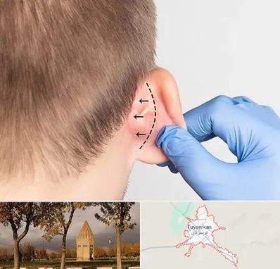 عمل زیبایی گوش در تویسرکان