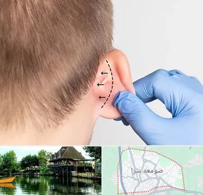 عمل زیبایی گوش در صومعه سرا