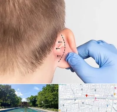 عمل زیبایی گوش در هشت بهشت اصفهان