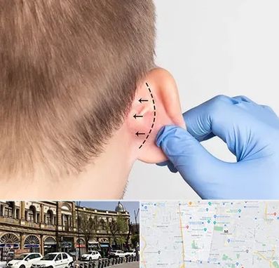 عمل زیبایی گوش در منطقه 11 تهران