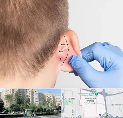 عمل زیبایی گوش در آپادانا