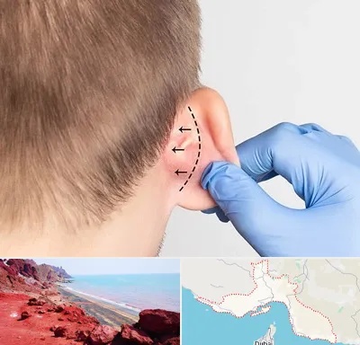 عمل زیبایی گوش در هرمزگان