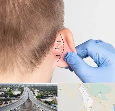 عمل زیبایی گوش در اندیمشک