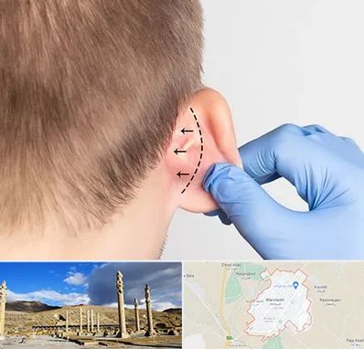 عمل زیبایی گوش در مرودشت