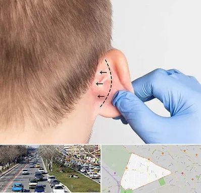 عمل زیبایی گوش در احمدآباد مشهد