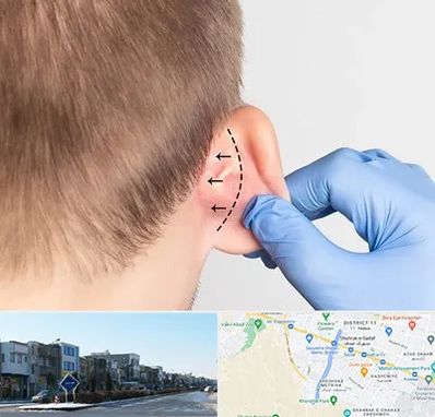 عمل زیبایی گوش در شریعتی مشهد