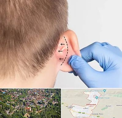 عمل زیبایی گوش در دماوند