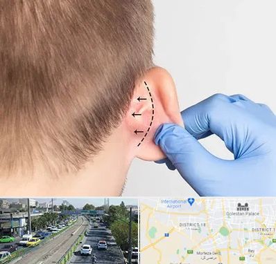 عمل زیبایی گوش در جنوب تهران