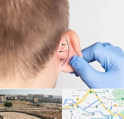عمل زیبایی گوش در کوی وحدت شیراز