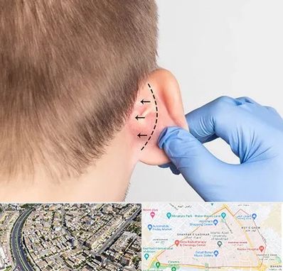 عمل زیبایی گوش در شهرک غرب مشهد