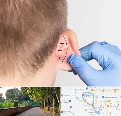 عمل زیبایی گوش در فلکه گاز رشت