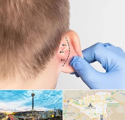 عمل زیبایی گوش در تهران