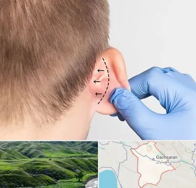 عمل زیبایی گوش در گچساران