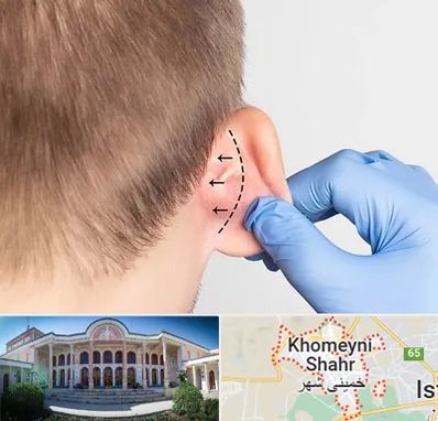 عمل زیبایی گوش در خمینی شهر