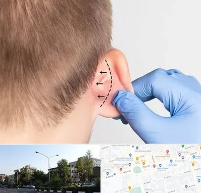 عمل زیبایی گوش در میدان کاج