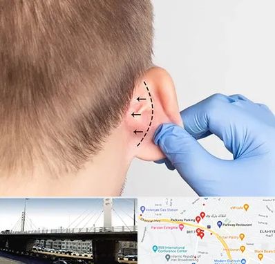 عمل زیبایی گوش در پارک وی