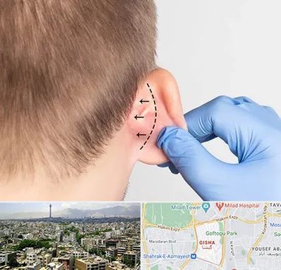 عمل زیبایی گوش در گیشا