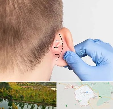 عمل زیبایی گوش در بهبهان