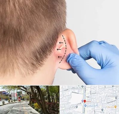 عمل زیبایی گوش در خیابان توحید اصفهان