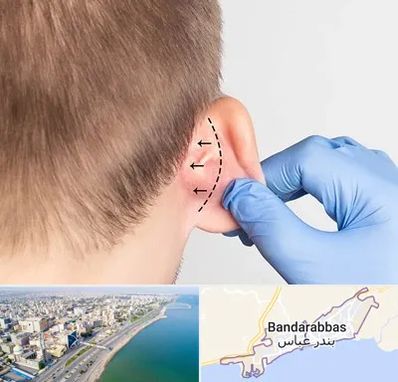 عمل زیبایی گوش در بندرعباس