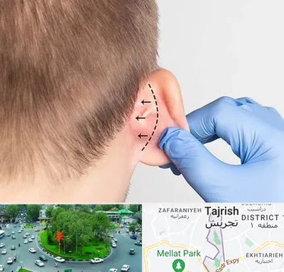 عمل زیبایی گوش در تجریش