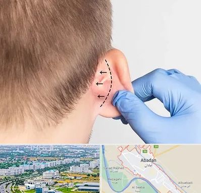 عمل زیبایی گوش در آبادان