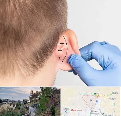 عمل زیبایی گوش در باغستان کرج