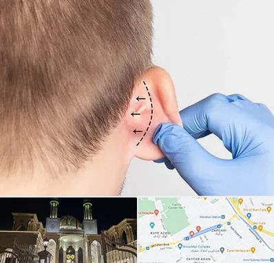 عمل زیبایی گوش در زرگری شیراز