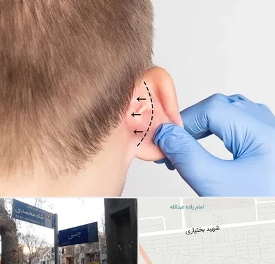 عمل زیبایی گوش در سی متری جی