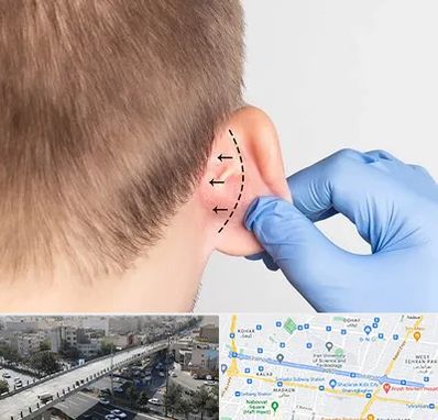 عمل زیبایی گوش در فرجام