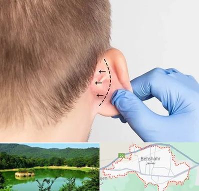عمل زیبایی گوش در بهشهر