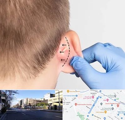 عمل زیبایی گوش در خیابان ملاصدرا شیراز