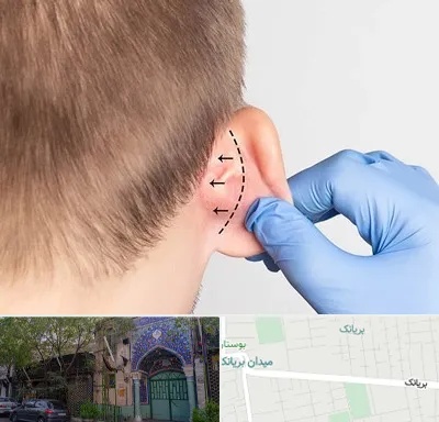 عمل زیبایی گوش در بریانک