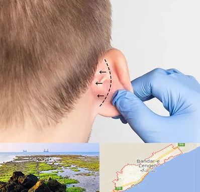 عمل زیبایی گوش در بندرلنگه