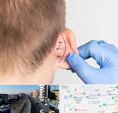 عمل زیبایی گوش در پیروزی