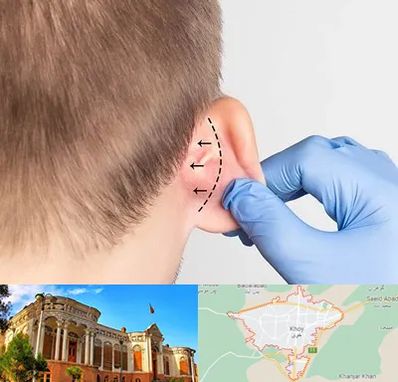 عمل زیبایی گوش در خوی