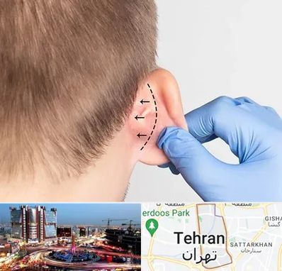 عمل زیبایی گوش در صادقیه تهران