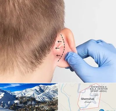 عمل زیبایی گوش در شمشک